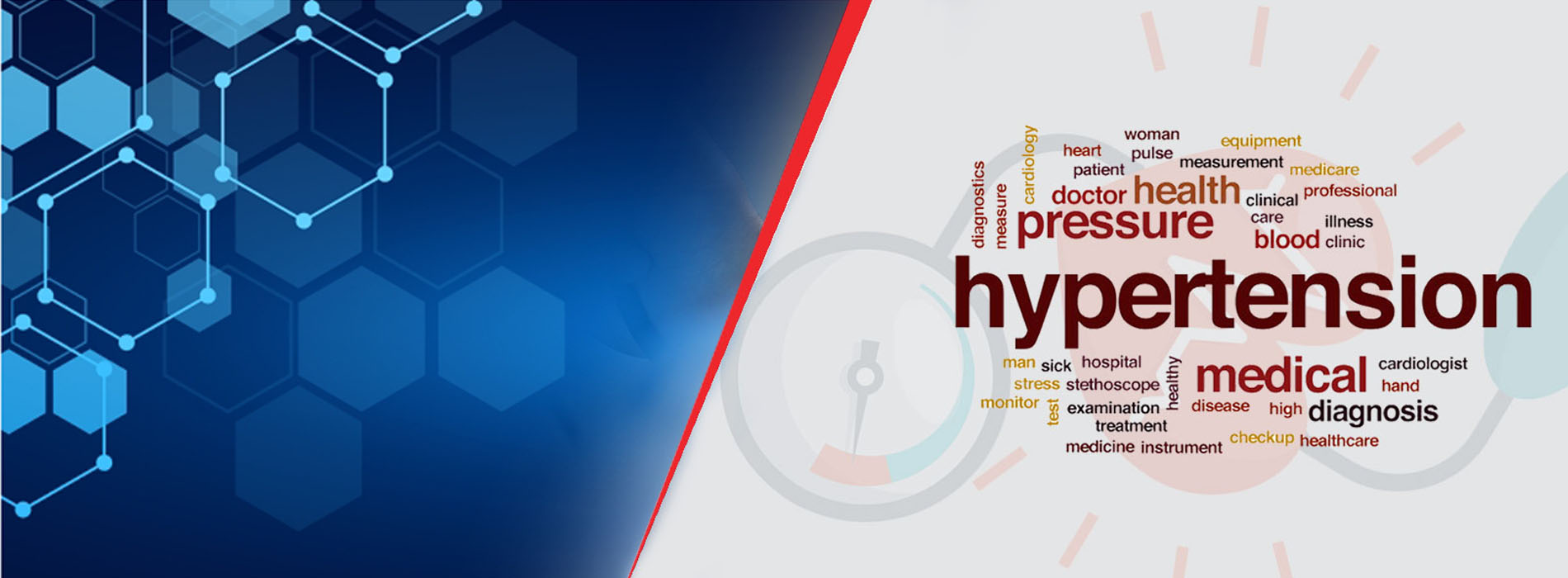hypertension treatment