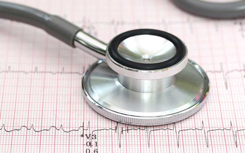 electrocardiography