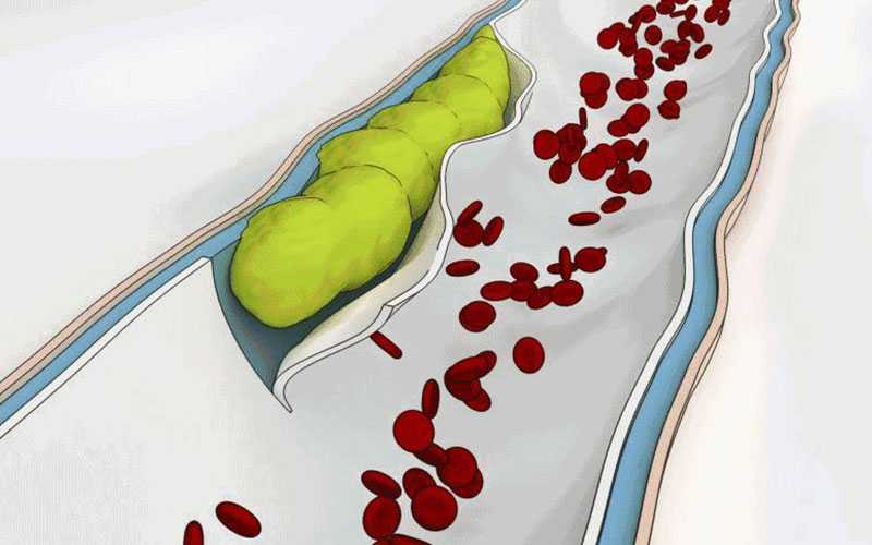 non invasivecardiology